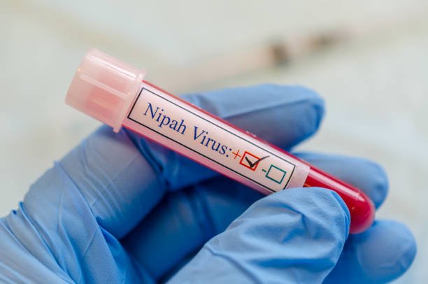 Nipah Virus Advisory: What UAE Passengers Travelling to India Should Know
